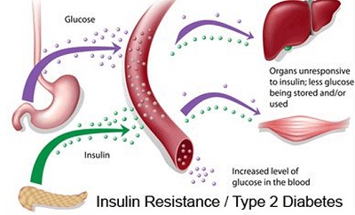 diabete-staminali-insulino-resistenti