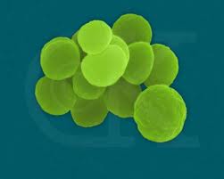 Gonorrea