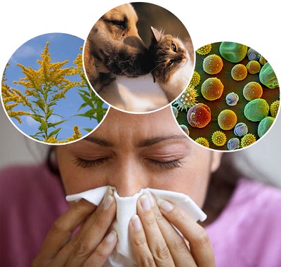 allergia immagine diagnosi