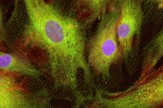 Cellule perivascolari da cordone ombelicale: isolamento e utilizzo in medicina rigenerativa
