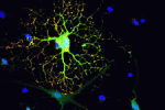 Un metodo semplice per la generazione di oligodendrociti da staminali neurali derivate dal cordone