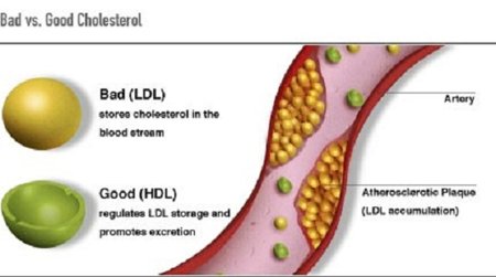 trigliceridi-colesterolo