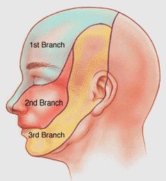 Illustrazione grafica di blocchi nervosi facciali che interessano l'anestesia locale