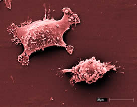 Microvescicole derivate da cellule staminali
