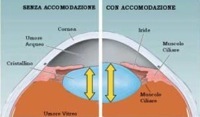 Immagine in cui si evidenzia in maniera strutturale la differenza con o senza l'accomodazione