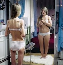 ragazza anoressica allo specchio