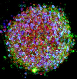 cellule-staminali-pluripotenti-indotte