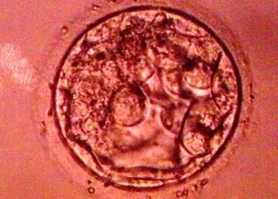 Immagine al microscopio di cellule staminali per retina