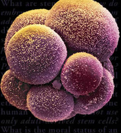 cellule-staminali