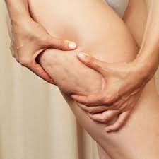 donna mentre mette in evidenza la presenza di cellulite