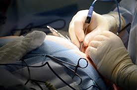 chirurgia-intervento-plastico