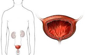 schema rappresentativo reni ureteri vescica
