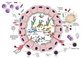 disbiosi-intestinale