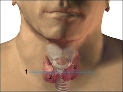 ecografia-tiroidea-tiroide