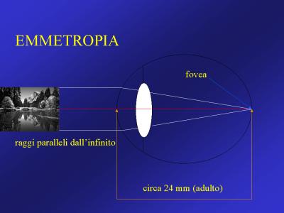 Scheda emmetropia accomodazione