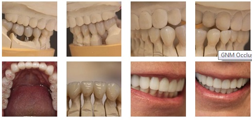 fasi evolutive che portano alla realizzazione di una corretta arcata dentale