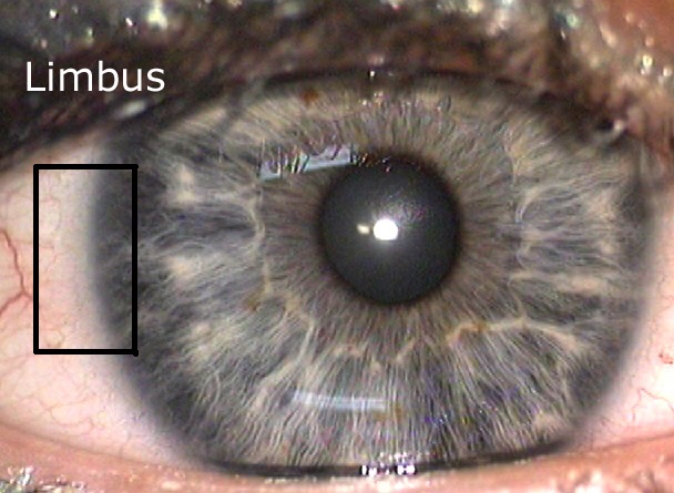 immagine relativa alla regione limbus