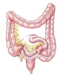  immagine grafica relativa ad intestino