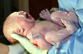 neonato subito dopo il parto