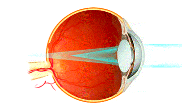 occhio-astigmatico copy