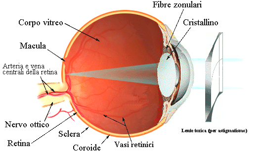 occhio-astigmaticoretina-sclera-coroide-retina-nervo-ottico