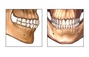 occlusione-bocca