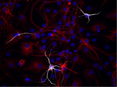 oligodentrici-stem-cell