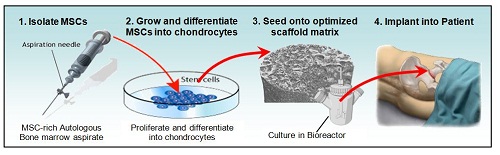 osso-cartilagine-rigenerazione