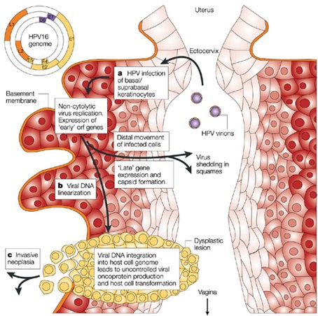 grafica rappresentante collo dell'utero con diagramma innesto virus papilloma