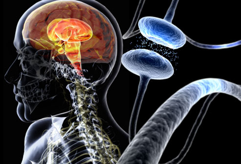 grafico in cui si rappresenta la patologia di Parkinson 