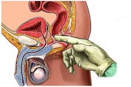 zona genitale maschile durante un controllo prostatico 