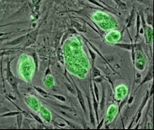staminali-cellule-tumori