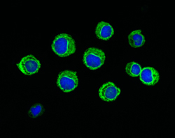 staminali-ematopoietiche-HSCT