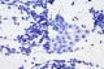 leggi tutto l'articolo Tumori: nanoparticelle per distruggere le metastasi - Retrò Online Tumori: nanoparticelle per distruggere le metastasi - Retrò Online