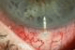 leggi tutto l'articolo Costruita la prima retina - Corriere della Sera Costruita la prima retina - Corriere della Sera