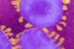leggi tutto l'articolo MERS-CoV: Un Nuovo Virus Minaccia L'Umanità - SALUTE E BENESSERE MERS-CoV: Un Nuovo Virus Minaccia L'Umanità - SALUTE E BENESSERE