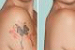 leggi tutto l'articolo Eliminare i tatuaggi, no al laser arriva una crema miracolosa - FocusTECH.it Eliminare i tatuaggi, no al laser arriva una crema miracolosa - FocusTECH.it