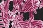 leggi tutto l'articolo Giornata Mondiale contro la Tubercolosi: diagnosi precoce per un ... - Notizie Free Giornata Mondiale contro la Tubercolosi: diagnosi precoce per un ... - Notizie Free