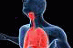 leggi tutto l'articolo Tumori in futuro per fumatori test allerta precoce cancro polmone - Padova News Tumori in futuro per fumatori test allerta precoce cancro polmone - Padova News