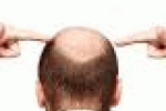 leggi tutto l'articolo Alopecia: trovato farmaco che fa ricrescere i capelli - Panorama Alopecia: trovato farmaco che fa ricrescere i capelli - Panorama