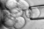 leggi tutto l'articolo Cellule staminali: buoni risultati contro ictus, la storia di Frank - NotizieIN Cellule staminali: buoni risultati contro ictus, la storia di Frank - NotizieIN