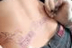 leggi tutto l'articolo Melanoma, i tatuaggi alzano il rischio di diagnosi tardiva - Vita di Donna Community Melanoma, i tatuaggi alzano il rischio di diagnosi tardiva - Vita di Donna Community