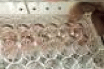 leggi tutto l'articolo Sanita': due casi scabbia nel trevigiano - ANSA.it Sanita': due casi scabbia nel trevigiano - ANSA.it