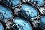 leggi tutto l'articolo Ecco come nasce e si diffonde l'Alzheimer. E come prenderlo in tempo - Panorama Ecco come nasce e si diffonde l'Alzheimer. E come prenderlo in tempo - Panorama
