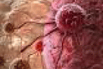 leggi tutto l'articolo Telomeri, tallone d'achille delle cellule tumorali - Italiasalute.it Telomeri, tallone d'achille delle cellule tumorali - Italiasalute.it