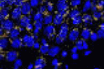 leggi tutto l'articolo Nanoparticelle contro le placche dell'Alzheimer - ANSA.it Nanoparticelle contro le placche dell'Alzheimer - ANSA.it