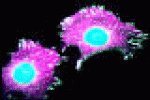 leggi tutto l'articolo Tumori: studio, in linfonodi nuove cellule anti-carcinoma - AGI - Agenzia Giornalistica Italia Tumori: studio, in linfonodi nuove cellule anti-carcinoma - AGI - Agenzia Giornalistica Italia