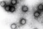 leggi tutto l'articolo Papilloma virus colpisce anche gli uomini - Rai News Papilloma virus colpisce anche gli uomini - Rai News