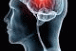 leggi tutto l'articolo Tumore al cervello, in arrivo un vaccino contro il glioma? - Salute24 - Il Sole 24 Ore Tumore al cervello, in arrivo un vaccino contro il glioma? - Salute24 - Il Sole 24 Ore