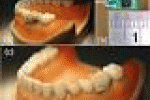 leggi tutto l'articolo Mangi troppo? Te lo dice il sensore nel dente - TGCOM Mangi troppo? Te lo dice il sensore nel dente - TGCOM